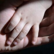 12-річна мешканка с. Краснилівка потребує допомоги на лікування